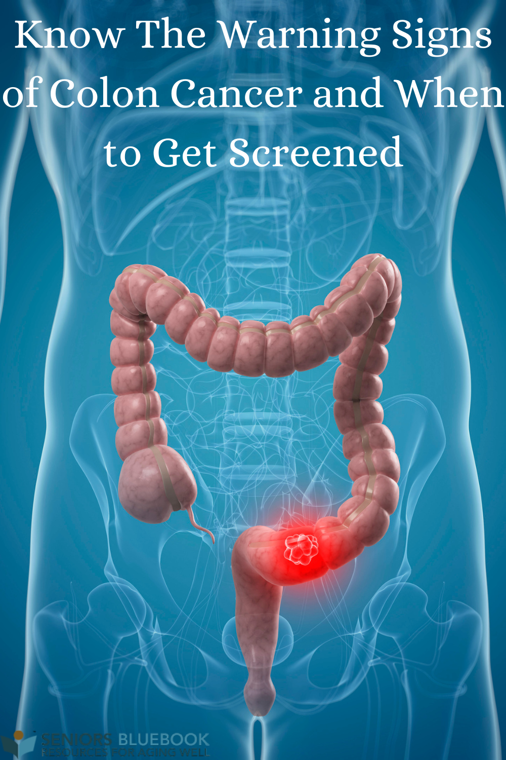 Articles - Know The Warning Signs of Colon Cancer and When to Get ...