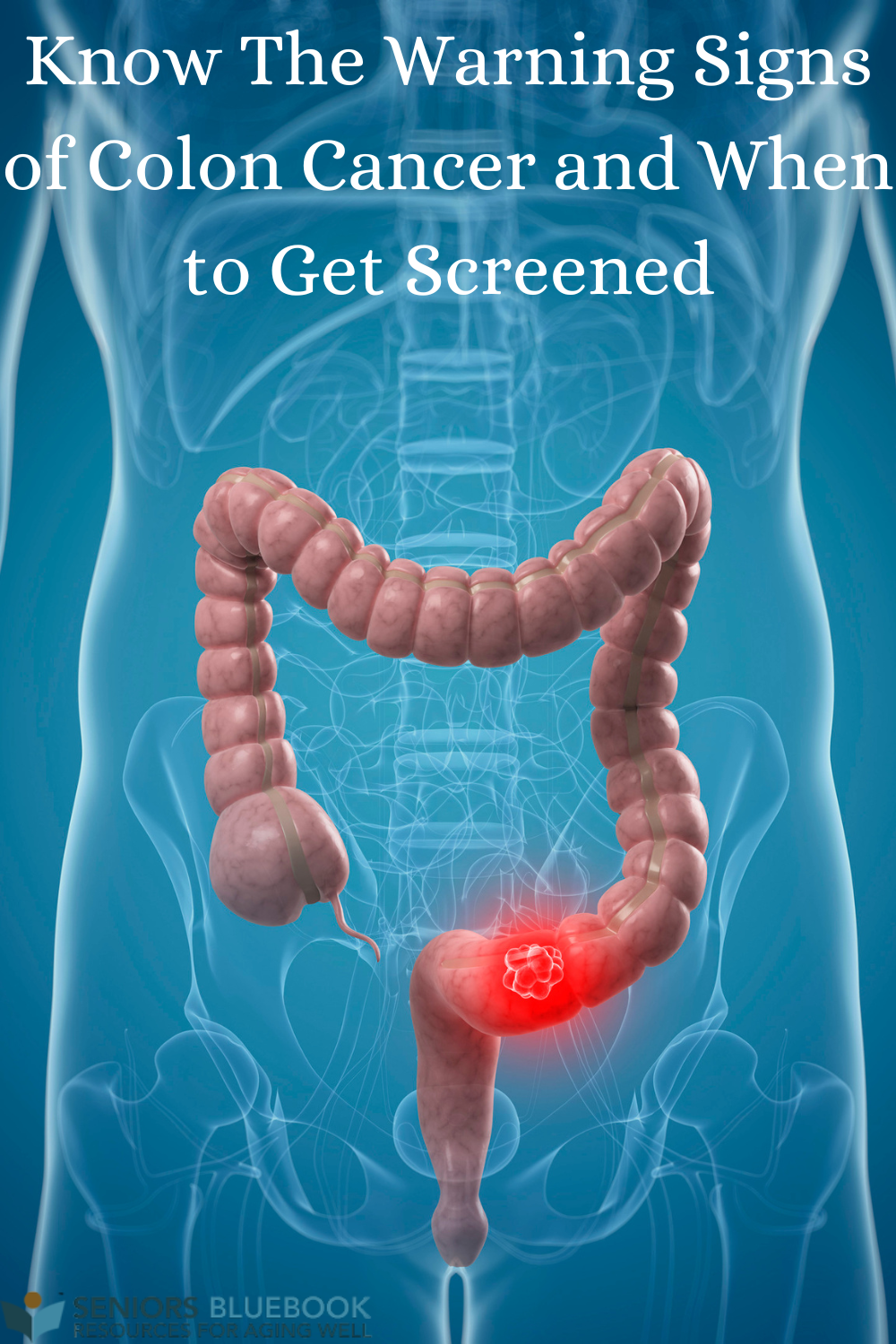 Articles - Know The Warning Signs Of Colon Cancer And When To Get 