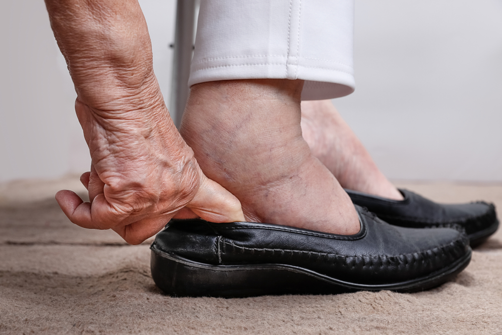 10 Signs Your Elderly Loved One Has Poor Circulation