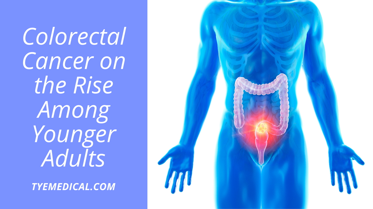 Colorectal Cancer on the Rise Among Younger Adults: Signs to Know