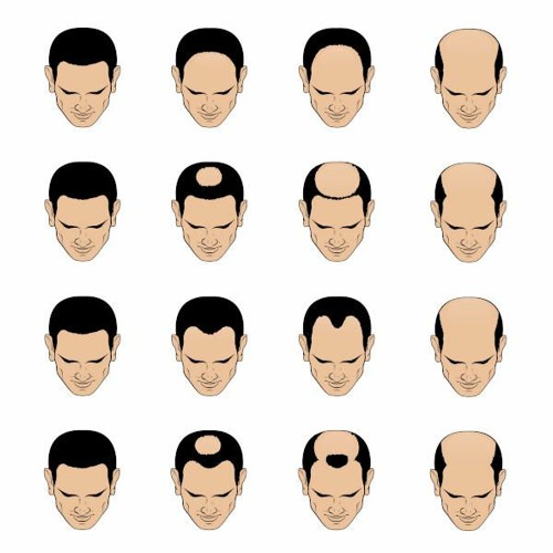 How Celebrities Secretly Deal with Male Pattern Baldness